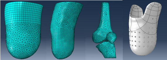 بومی سازی طراحی و ساخت سوکت پای مصنوعی با فناوری چاپ سه‌بعدی توسط محققان دانشگاه صنعتی اصفهان